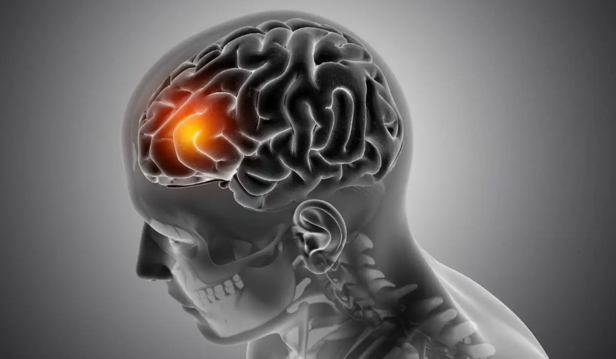 Male medical figure with front of the brain highlighted