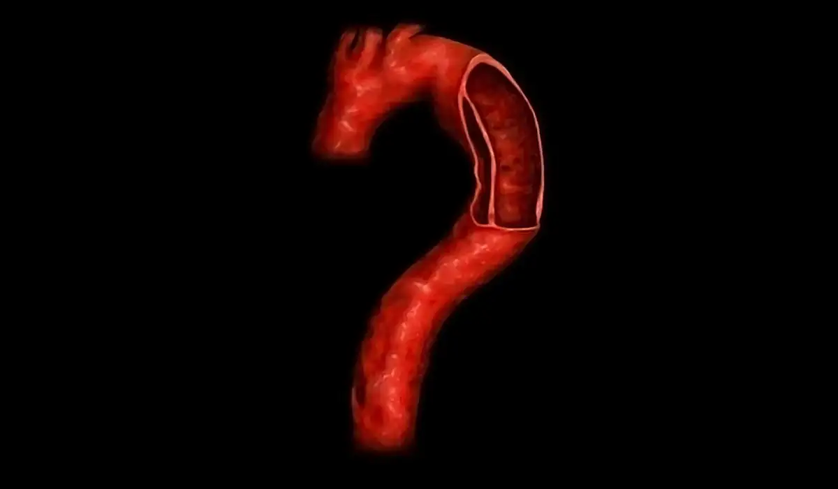 Aortic dissection on a black background